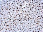 PCNA Antibody in Immunohistochemistry (Paraffin) (IHC (P))