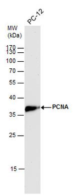 PCNA Antibody in Western Blot (WB)