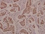 Phospho-PPAR gamma (Ser112) Antibody in Immunohistochemistry (Paraffin) (IHC (P))