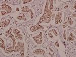 Phospho-PPAR gamma (Ser112) Antibody in Immunohistochemistry (Paraffin) (IHC (P))