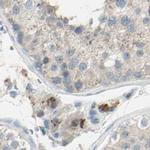 B4GALT1 Antibody in Immunohistochemistry (IHC)