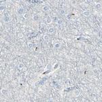 B4GALT1 Antibody in Immunohistochemistry (IHC)