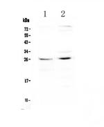 CTR1 Antibody in Western Blot (WB)