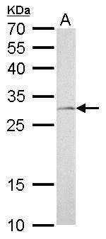 NQO1 Antibody in Western Blot (WB)