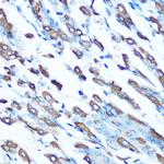 SLC11A2 Antibody in Immunohistochemistry (Paraffin) (IHC (P))