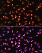 NQO1 Antibody in Immunocytochemistry (ICC/IF)