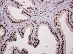 PCNA Antibody in Immunohistochemistry (Paraffin) (IHC (P))