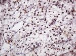 PCNA Antibody in Immunohistochemistry (Paraffin) (IHC (P))