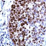 PCNA Antibody in Immunohistochemistry (Paraffin) (IHC (P))