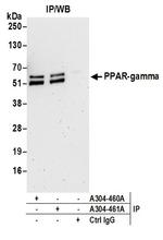 PPAR-gamma Antibody in Immunoprecipitation (IP)