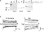 Connexin 26 Antibody in Western Blot (WB)