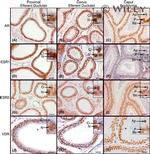 VDR Antibody in Immunohistochemistry (IHC)