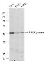 PPAR gamma Antibody in Western Blot (WB)