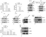 Bcl-2 Antibody in Western Blot (WB)