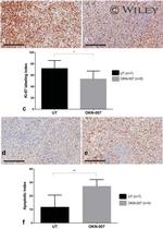 Ki-67 Antibody in Immunohistochemistry (IHC)