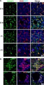 CD45 Antibody in Immunohistochemistry (IHC)