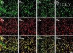 Connexin 26 Antibody in Immunohistochemistry (IHC)