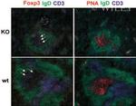 FOXP3 Antibody in Immunohistochemistry (IHC)