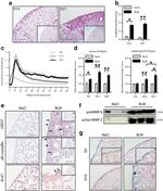 Ki-67 Antibody in Immunohistochemistry, Immunohistochemistry (Paraffin) (IHC, IHC (P))