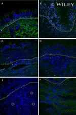 Connexin 26 Antibody in Immunohistochemistry (IHC)