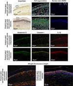 Caspase 1 Antibody in Immunohistochemistry (IHC)