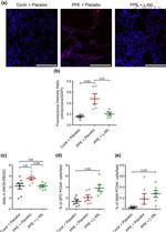 PCNA Antibody in Immunohistochemistry (IHC)