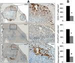 FOXP3 Antibody in Immunohistochemistry (IHC)