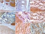 CD117 (c-Kit) Antibody in Immunohistochemistry (IHC)