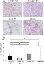 FOXP3 Antibody in Immunohistochemistry (IHC)