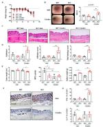 IFN gamma Antibody in Immunohistochemistry (IHC)