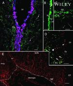 Connexin 26 Antibody in Immunohistochemistry (IHC)