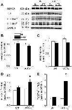 Phospholamban Antibody in Western Blot (WB)