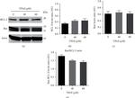 Bcl-2 Antibody in Western Blot (WB)