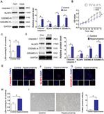 GSDMD Antibody in Western Blot (WB)