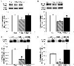 Calreticulin Antibody in Western Blot (WB)