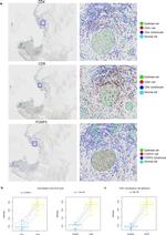 FOXP3 Antibody in Immunohistochemistry (IHC)