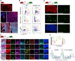 Ki-67 Antibody in Immunohistochemistry (Frozen) (IHC (F))