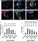 PCNA Antibody in Immunohistochemistry (IHC)