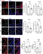 CD3e Antibody in Immunohistochemistry (IHC)