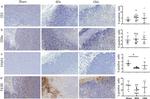 FOXP3 Antibody in Immunohistochemistry (IHC)