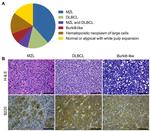 CD45R (B220) Antibody in Immunohistochemistry (IHC)