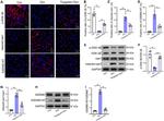 GSDMD Antibody in Immunohistochemistry (PFA fixed) (IHC (PFA))