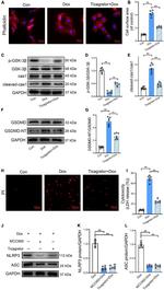 GSDMD Antibody in Western Blot (WB)