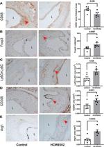 FOXP3 Antibody in Immunohistochemistry (IHC)