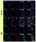 Connexin 26 Antibody in Immunohistochemistry (IHC)