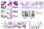 VDR Antibody in Immunohistochemistry (IHC)