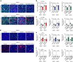 Ki-67 Antibody in Immunohistochemistry (IHC)