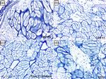 CD117 (c-Kit) Antibody in Immunohistochemistry (Paraffin) (IHC (P))