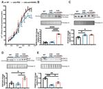 Phospholamban Antibody in Western Blot (WB)