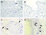 FOXP3 Antibody in Immunohistochemistry (IHC)